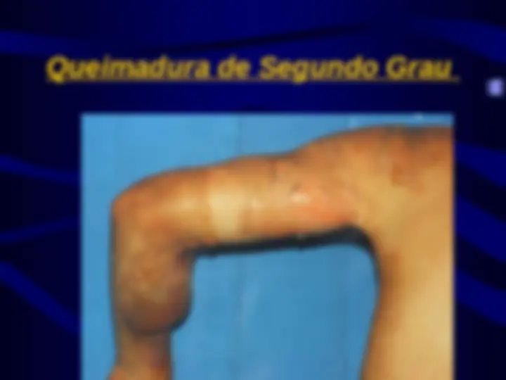 pfe