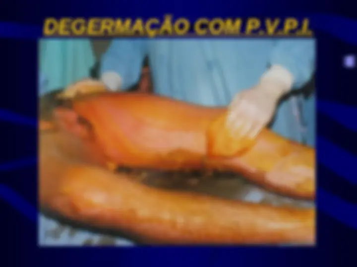 pf4b