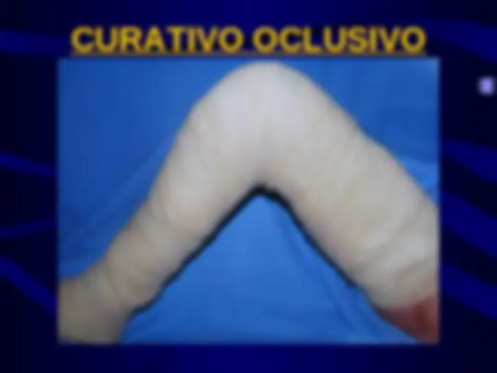pf51