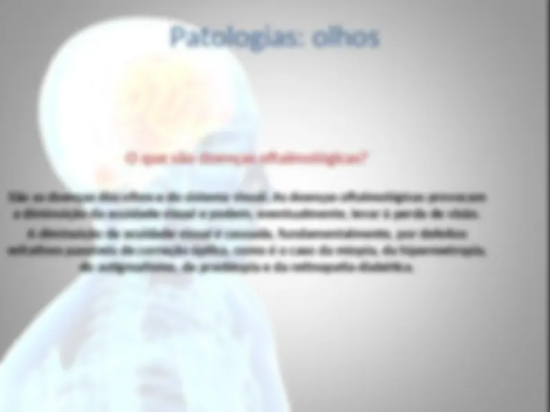 pfe