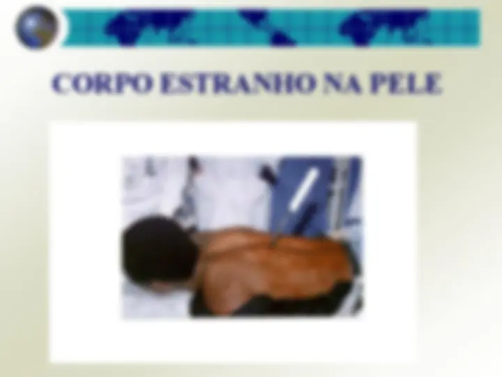 pff