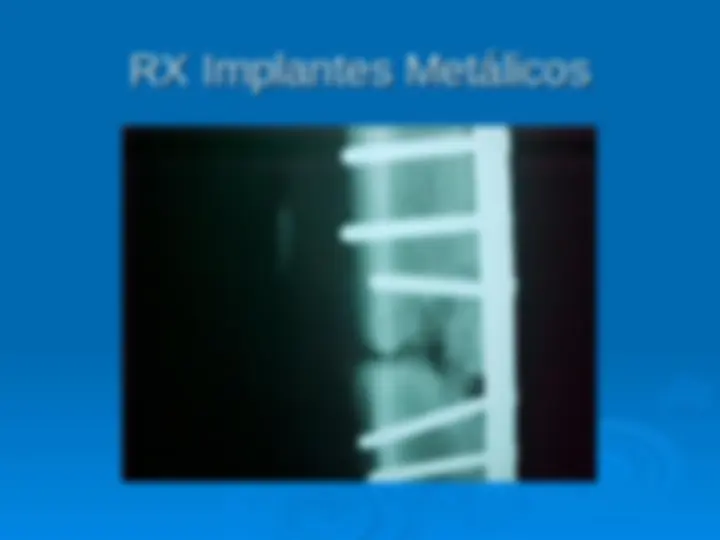 pf12