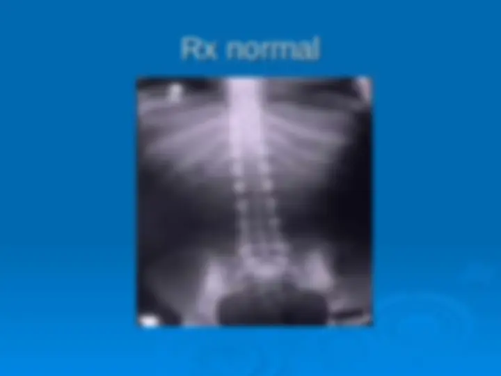 pf5