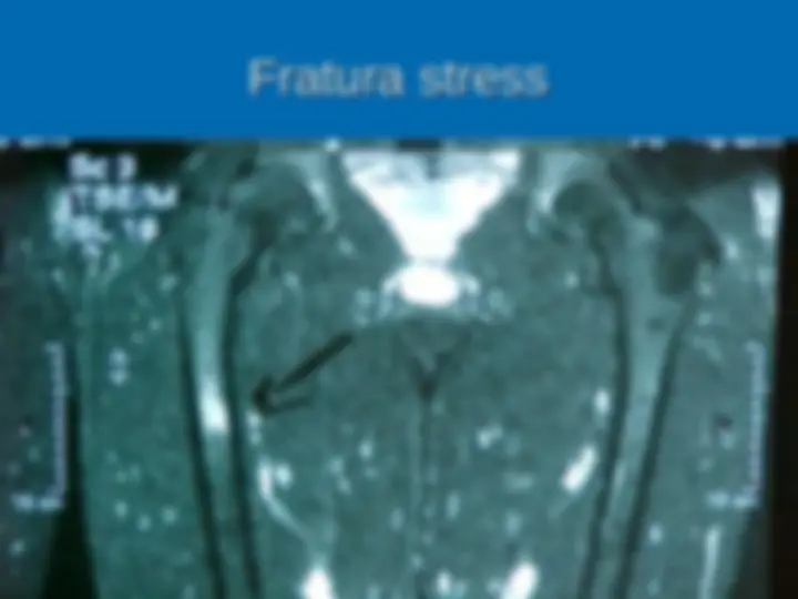 pf23