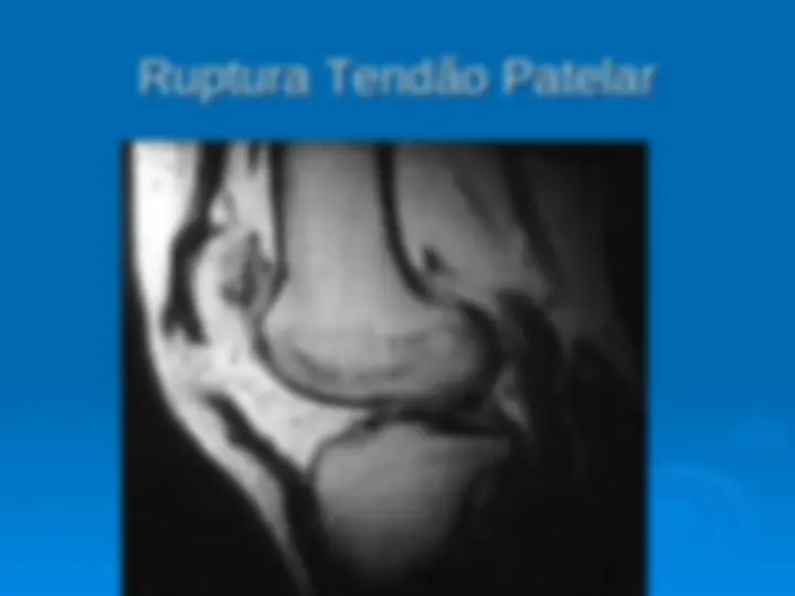 pf26