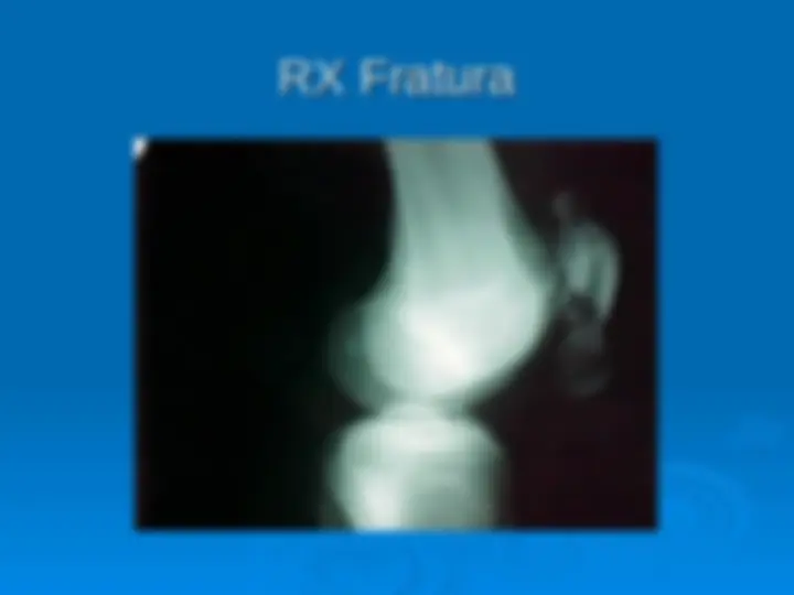 pf8