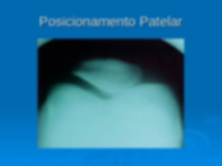 pf1a