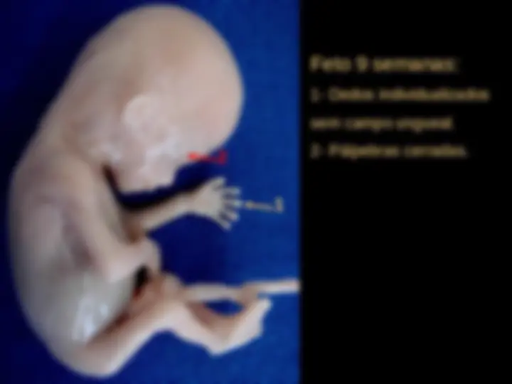 pf4
