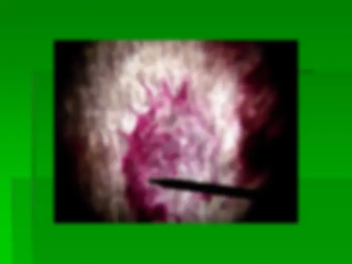 pfa