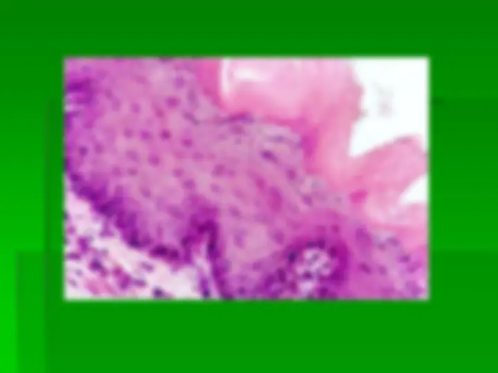 pf4