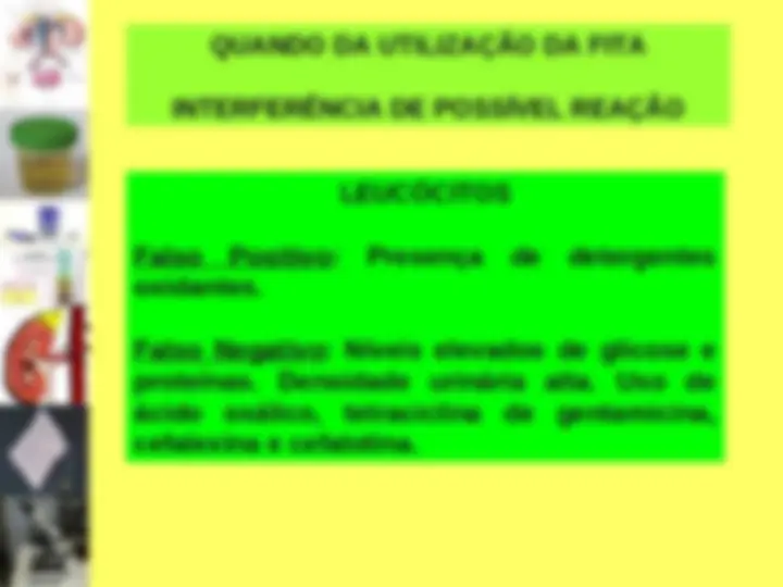 pfe