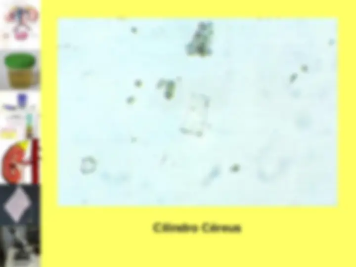 pf51