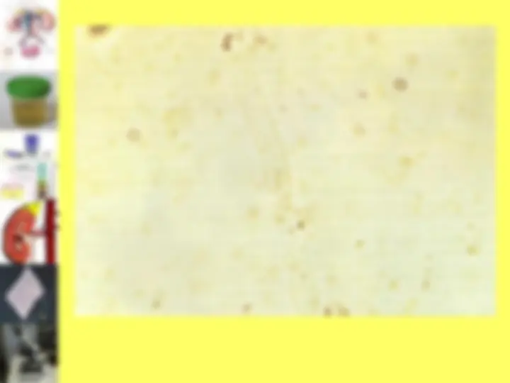 pf4a
