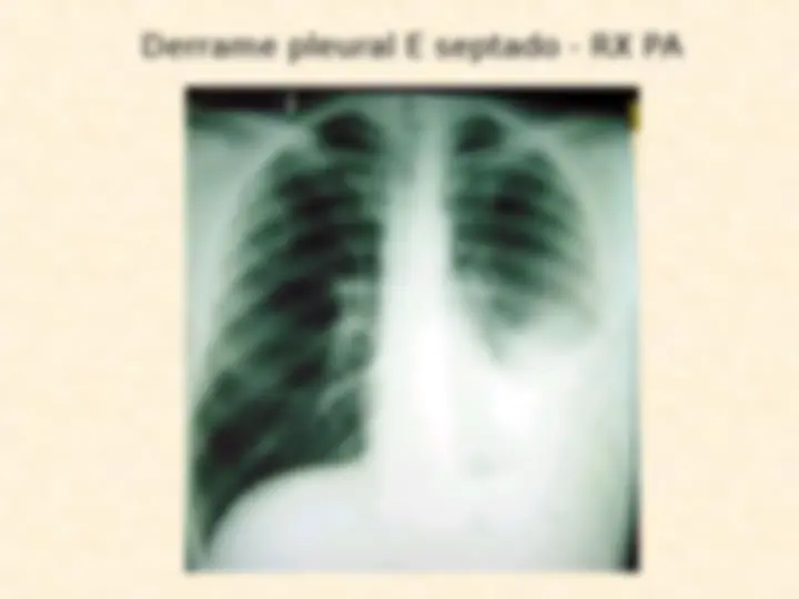 pf13