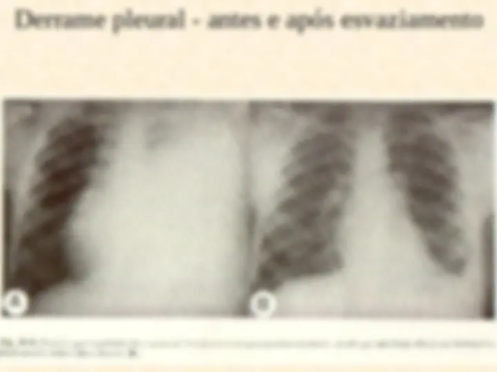 pf19