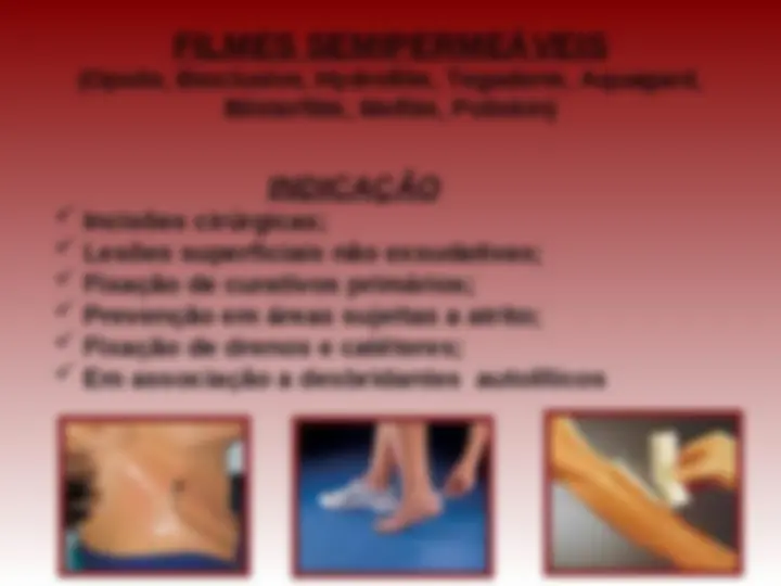 pf34
