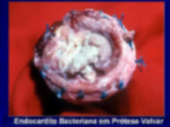 pf14