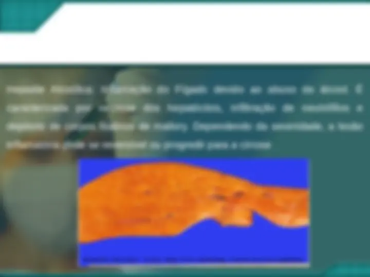 pfa
