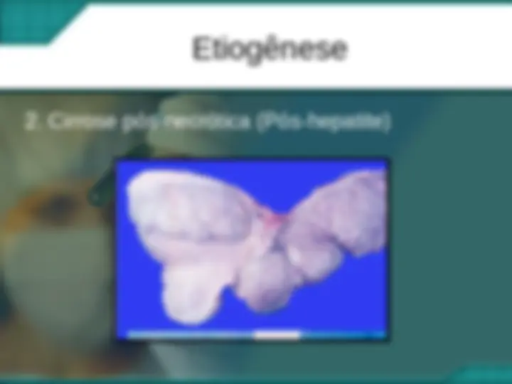 pfe