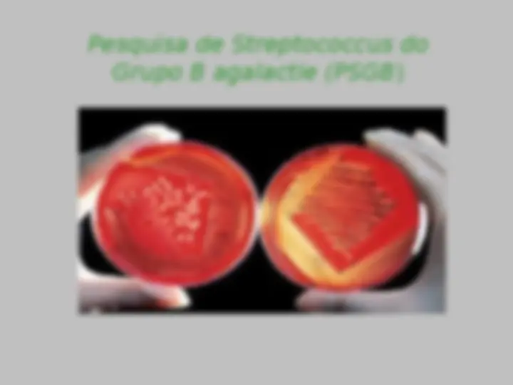 pf5