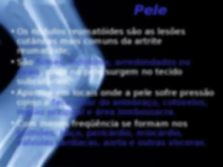 pf15