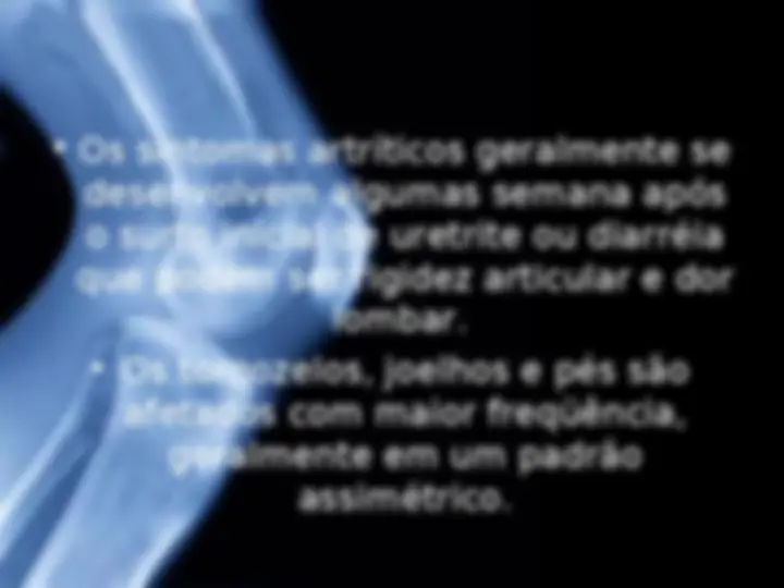 pf27