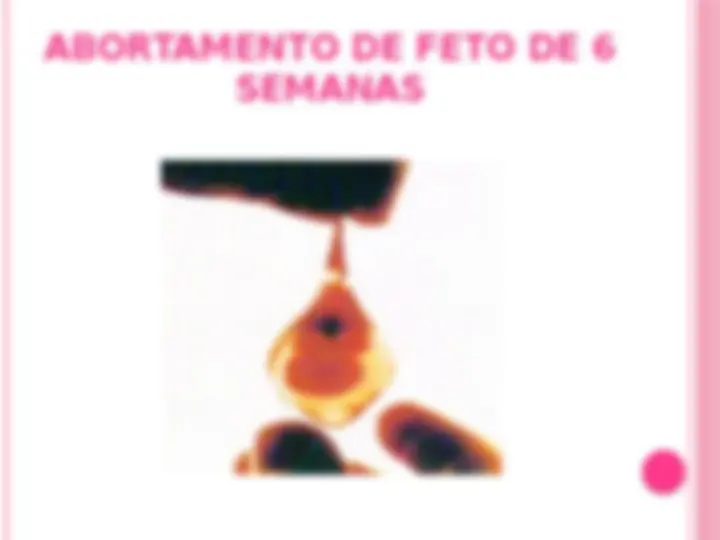 pfa