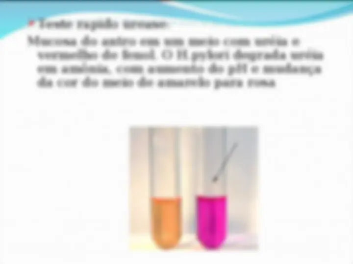 pf13