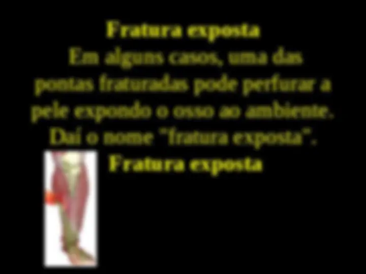 pfa