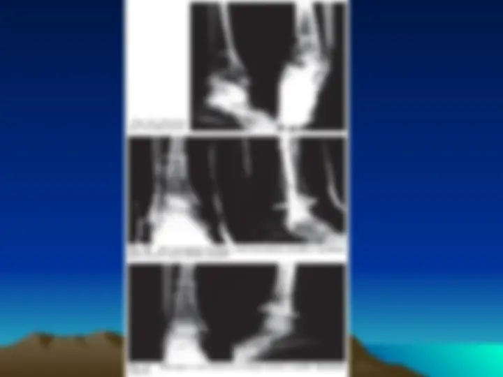 pf16