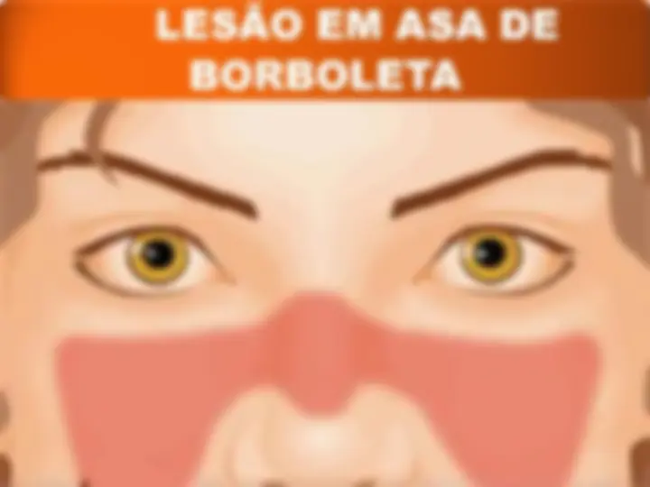 pfa