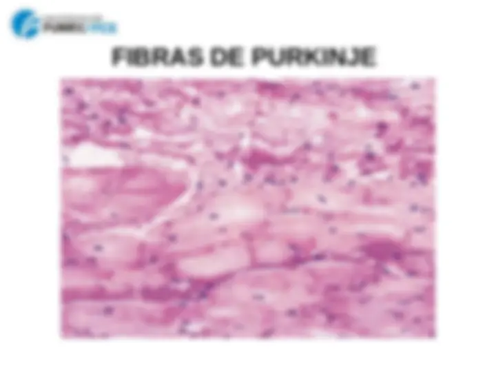 pf1b