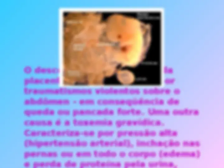 pf34