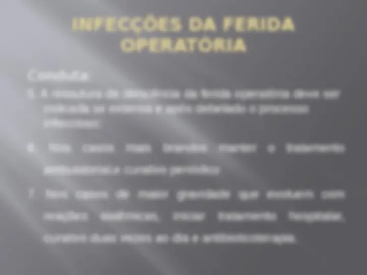 pfe
