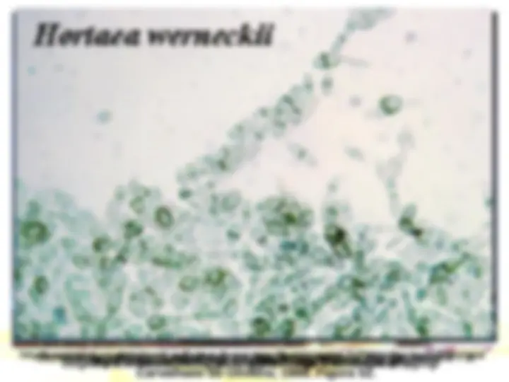 pf14