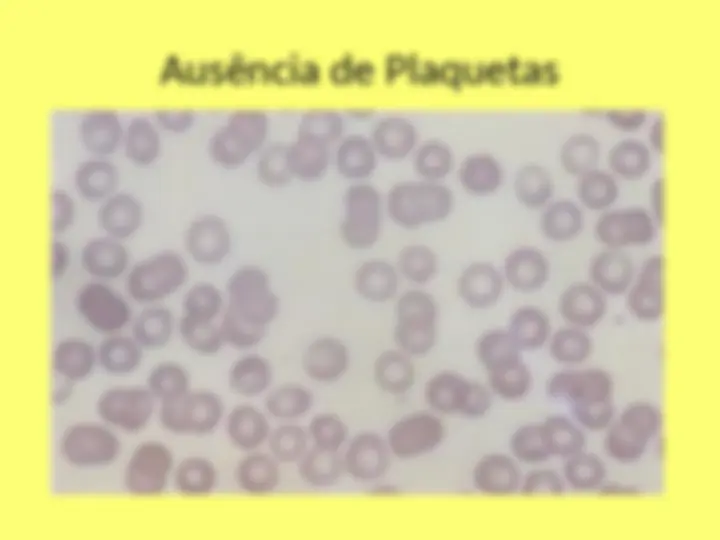 pf17