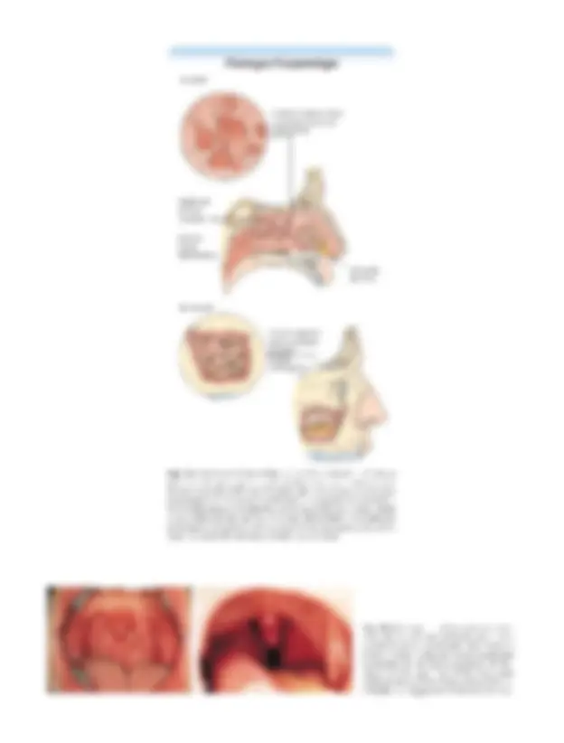 pfa