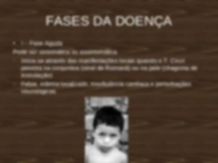 pfe