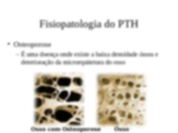 pf21