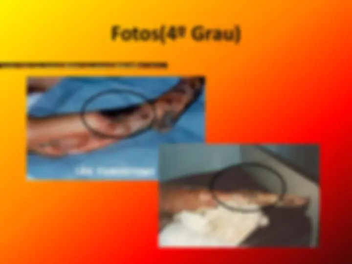 pf12