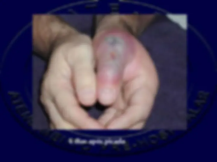pf38