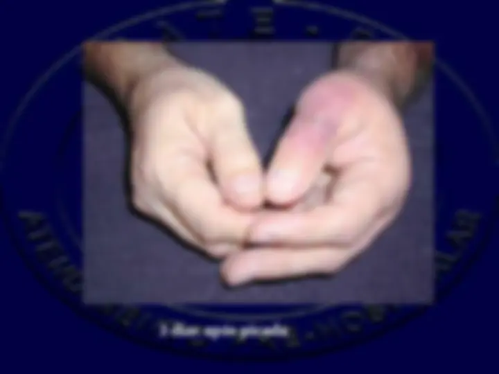 pf35