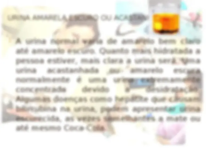 pfe