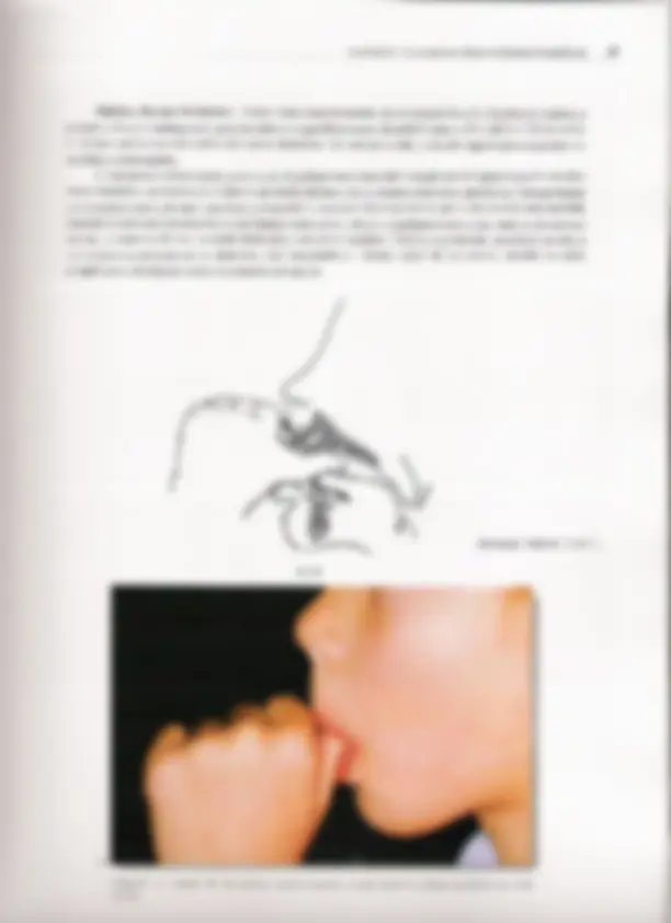 pf23