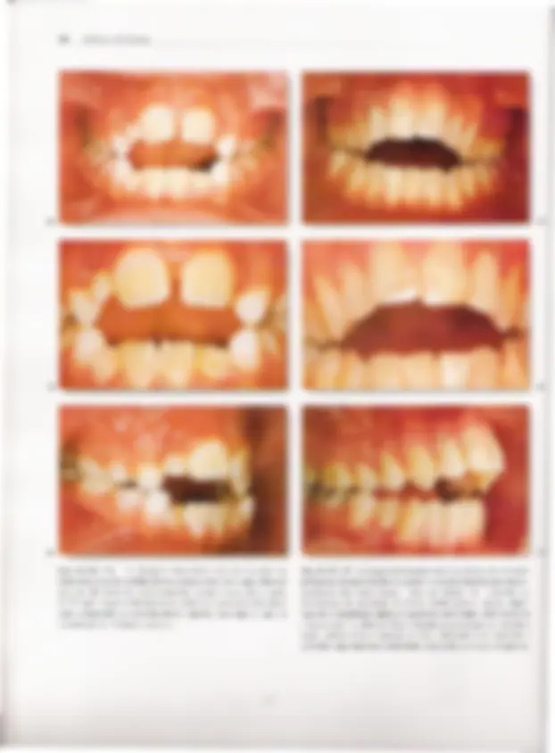 pf24