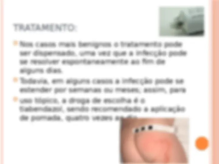 pfa