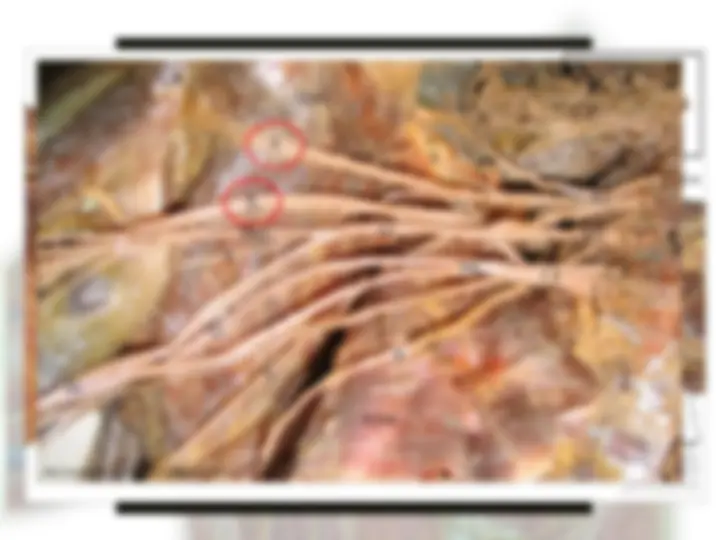 pfa