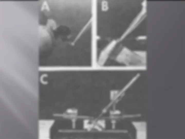pf15
