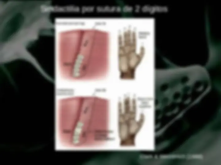 pf13