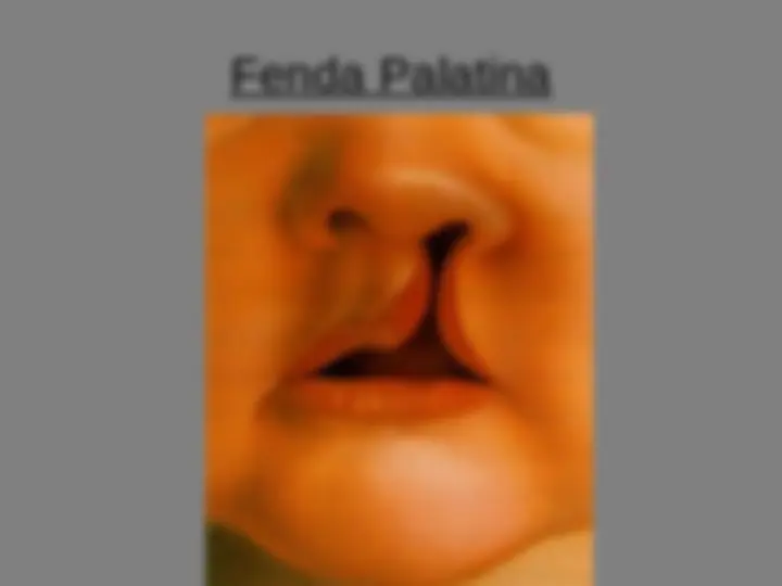 pf17